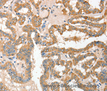 CD156c Polyclonal Antibody