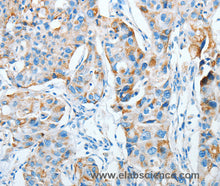 AGA Polyclonal Antibody