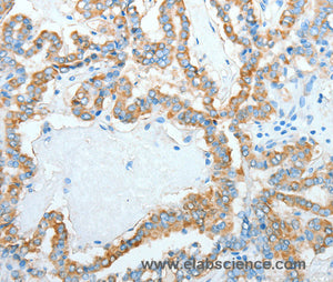 AGR3 Polyclonal Antibody