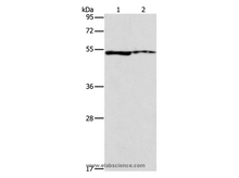 ALDH3A1 Polyclonal Antibody