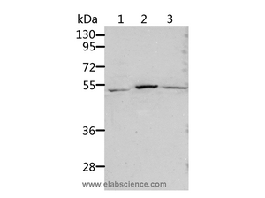 ALDH3B1 Polyclonal Antibody