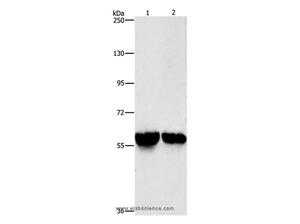 ALDH8A1 Polyclonal Antibody