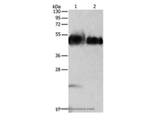 ORM1 Polyclonal Antibody