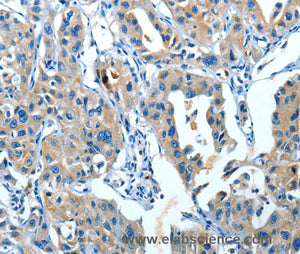 SERPINA3 Polyclonal Antibody