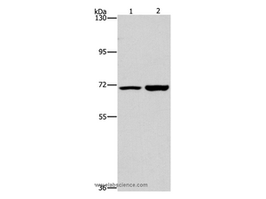 PIP5K1A Polyclonal Antibody