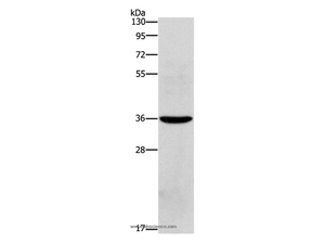 OLR1 Polyclonal Antibody