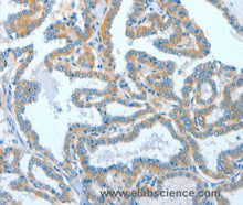 ASCC1 Polyclonal Antibody