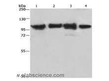 ACTN4 Polyclonal Antibody