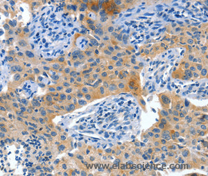 Placental Alkaline Phosphatase Polyclonal Antibody