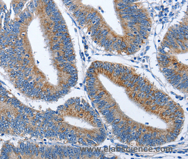 CADM3 Polyclonal Antibody