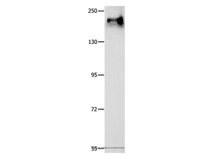 ABCC1 Polyclonal Antibody