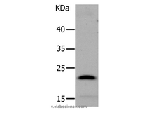 LCN2 Polyclonal Antibody