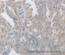 TACR2 Polyclonal Antibody