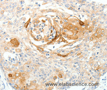SCN10A Polyclonal Antibody