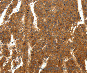 SCN11A Polyclonal Antibody