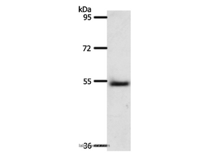 A1BG Polyclonal Antibody