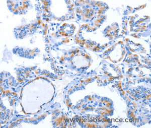 WNT1 Polyclonal Antibody