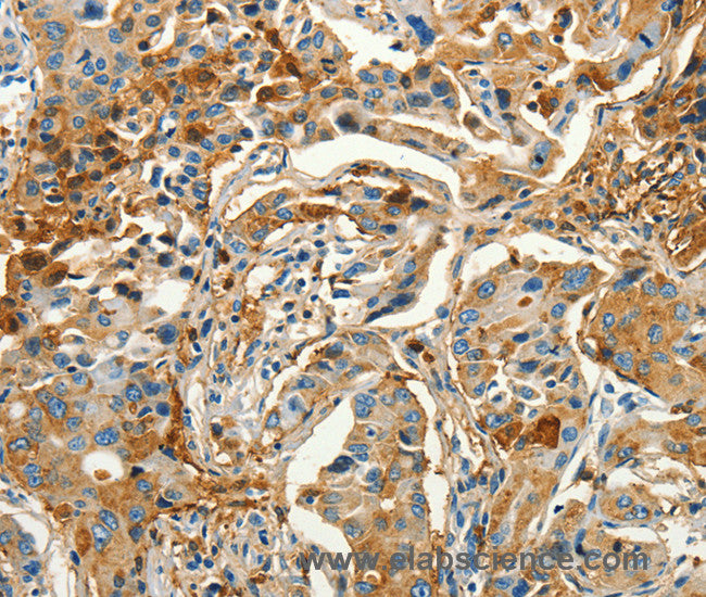CALCA Polyclonal Antibody