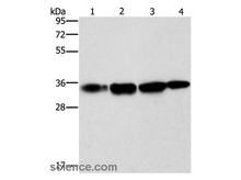 NSMCE3 Polyclonal Antibody