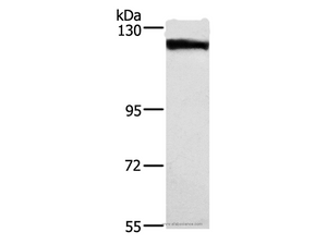 DSG1 Polyclonal Antibody