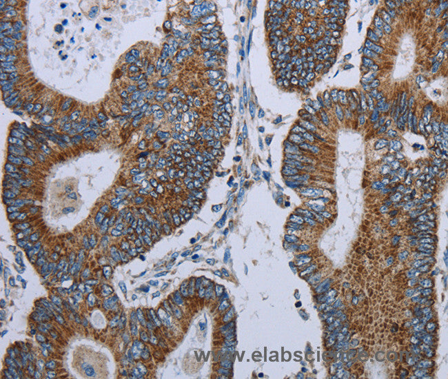 ELAVL3 Polyclonal Antibody
