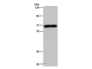 NMT1 Polyclonal Antibody