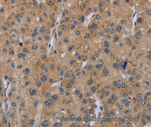 SLC22A2 Polyclonal Antibody