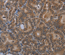 SLC22A2 Polyclonal Antibody