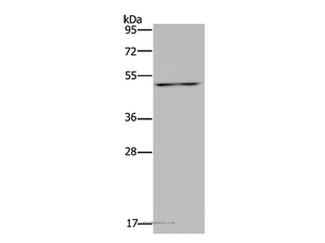 P2RX2 Polyclonal Antibody