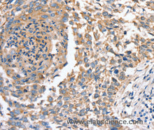 SLC16A10 Polyclonal Antibody