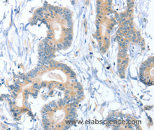 SNX29 Polyclonal Antibody