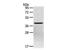 PTX3 Polyclonal Antibody