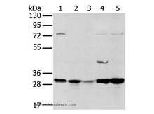 TPD54 Polyclonal Antibody