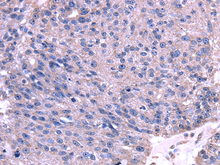 TRIM14 Polyclonal Antibody