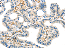 CCDC99 Polyclonal Antibody