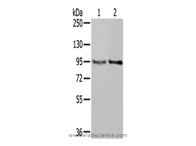 NUP98 Polyclonal Antibody