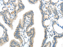 VPS4A Polyclonal Antibody