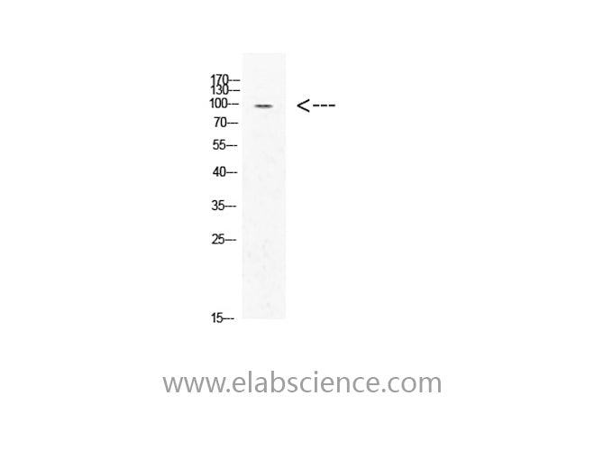 Acetyl-AR (Lys631) Polyclonal Antibody