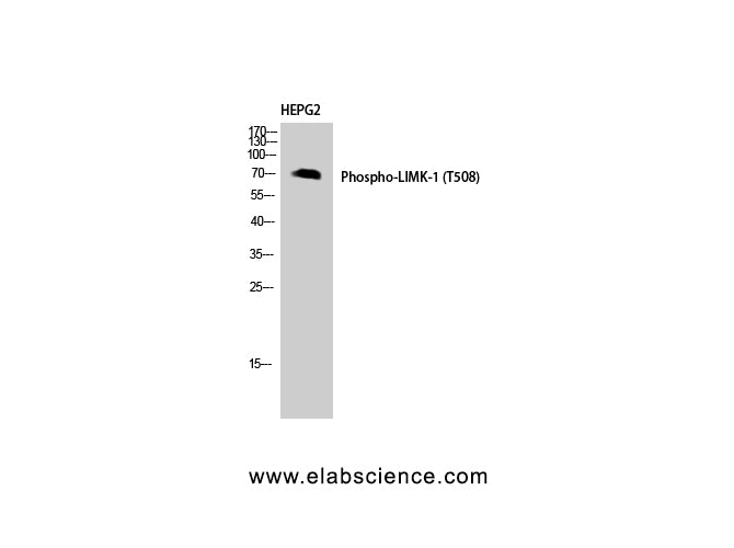 Phospho-LIMK1 (Thr508) Polyclonal Antibody