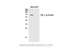 Phospho-PKC zeta (Thr560) Polyclonal Antibody