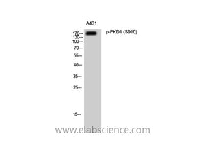 Phospho-PRKD1 (Ser910) Polyclonal Antibody