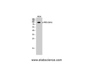 Phospho-PRKD2 (Ser876) Polyclonal Antibody