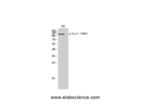 Phospho-TEK (Tyr992) Polyclonal Antibody