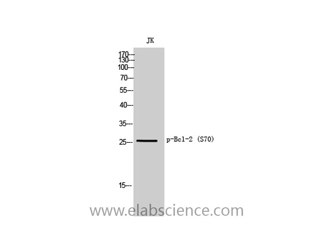 Phospho-BCL2 (Ser70) Polyclonal Antibody