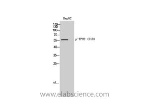 Phospho-TPH2 (Ser19) Polyclonal Antibody