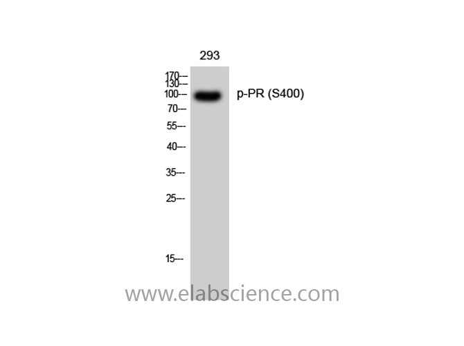Phospho-PGR (Ser400) Polyclonal Antibody
