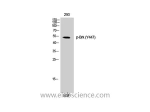 Phospho-PTK6 (Tyr447) Polyclonal Antibody