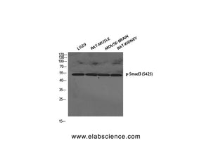 Phospho-SMAD3 (Ser425) Polyclonal Antibody