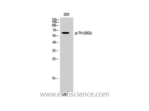 Phospho-TH (Ser62) Polyclonal Antibody