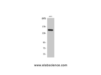 Phospho-PLCB3 (Ser1105) Polyclonal Antibody